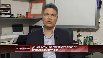 ¿A qué edad aparece la neurofibromatosis?