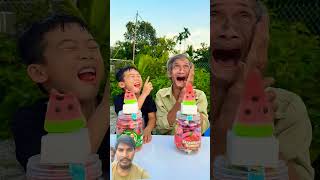बुढ़ा आदमी का दांत निकल आया 😂#shorts #funny #comedy #shortvideo #comedy
