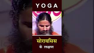 soriasis ke lakshan | सोरायसिस  के लक्षण  Ayurvedic Support