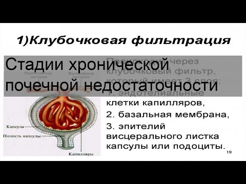 Стадии хронической почечной недостаточности