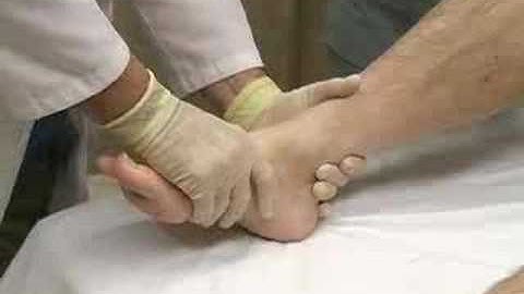 Dislocation Reduction Ankle (sample) - proceduresconsult.com