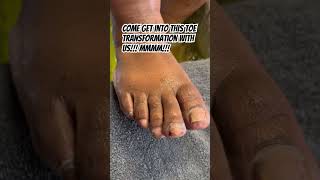 So who wants more satisfying toe transformations pedicure satisfying