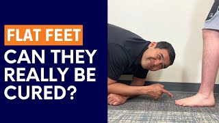 Can Flat Feet Really Be Cured?