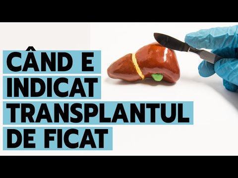 Video: De ce este mai bine transplantul decât difuzarea?