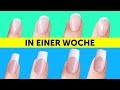 Wie Schnell Wachsen Nägel Am Tag