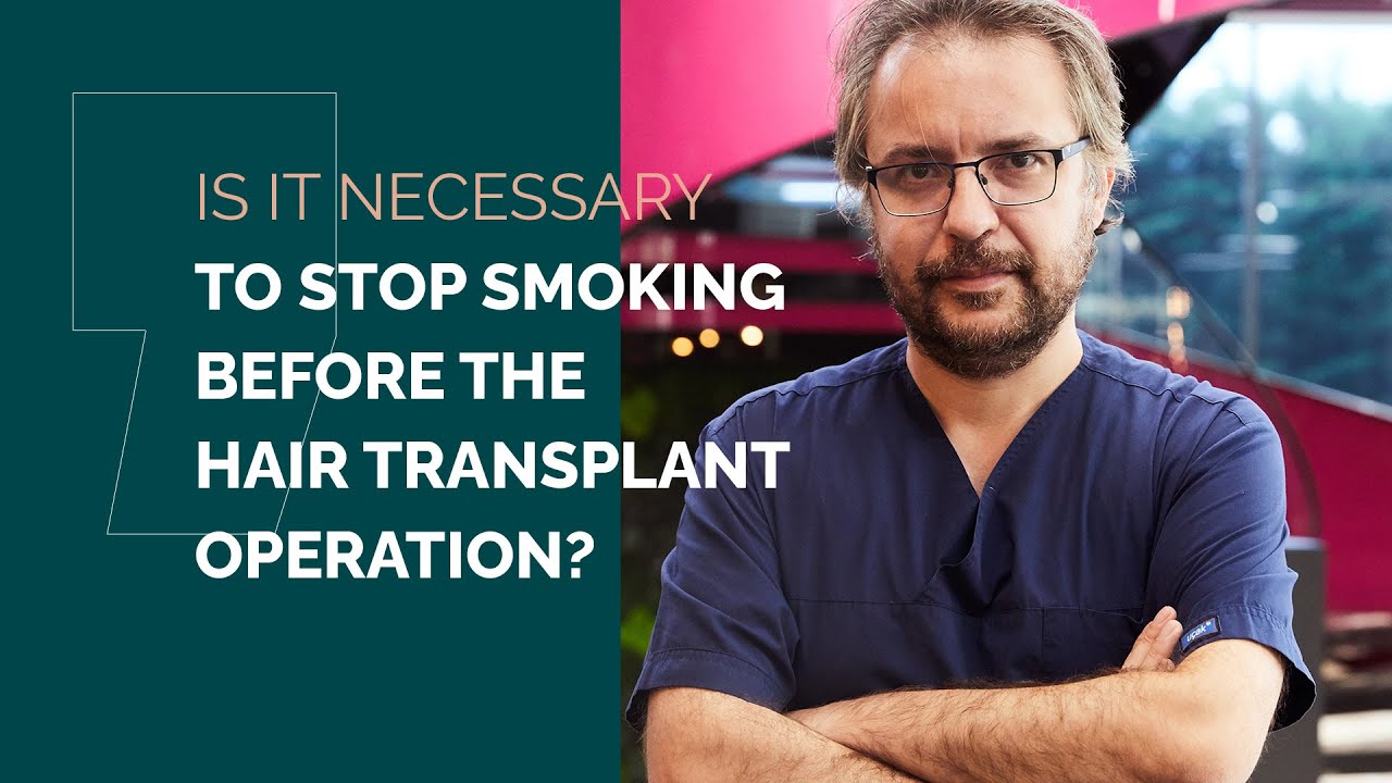 Is It Necessary to Stop Smoking Before the Hair Transplant Operation