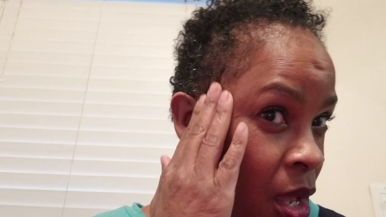 Vicks Vapor Rub Hair Growth Update YouTube