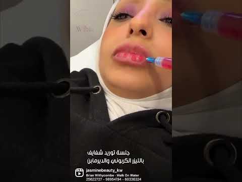 جلسة توريد علاجي للشفايف