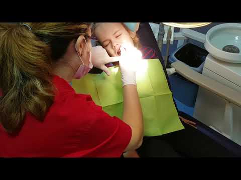 Video: Kus: Mergi La Dentist Ca Tendință De Machiaj