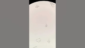 the process of freezing water under a microscope #microscopic #biology  #new  #trend ,#zoom