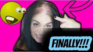 Thin and Bald Hair Magic!!! My Routine EVERYDAY watch the whole video to see(TO ORDER: go to my Facebook Page,request me and there you will see the color chart as well as videos... giveaways, sales etc HERE IS MY FACE BOOK ..., 2013-08-20T15:03:08.000Z)