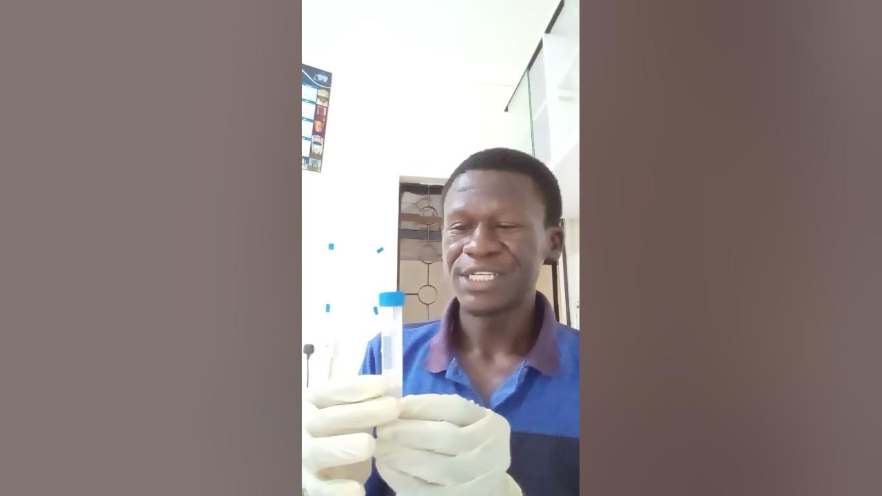 URINALYSIS PROCEDURE/DIPSTICK WITH COMBOW 10 STRIPS. YouTube
