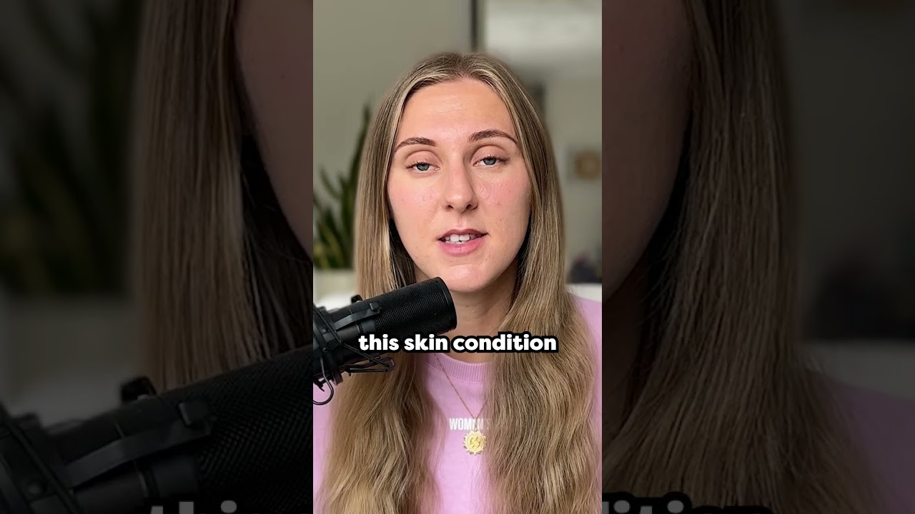 I have been suffering with a skin condition