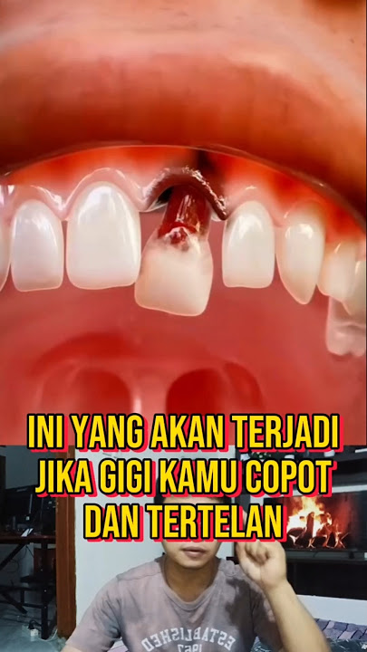 BE CAREFUL IF YOUR TOOTH FALLS OUT AND IS SWALLOWED #truestory #facts