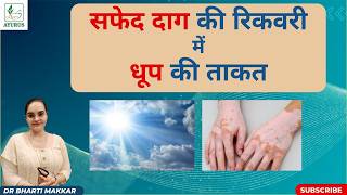 The Power of Sunlight in Vitiligo Recovery | Sun Therapy Explained #drbhartimakkar