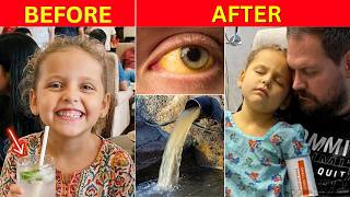 A 7-Year-Old Drank Nimbu Pani In India. 29 Days Later, Her Liver Failed.