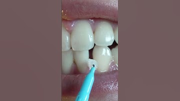 How to use interdental brushes