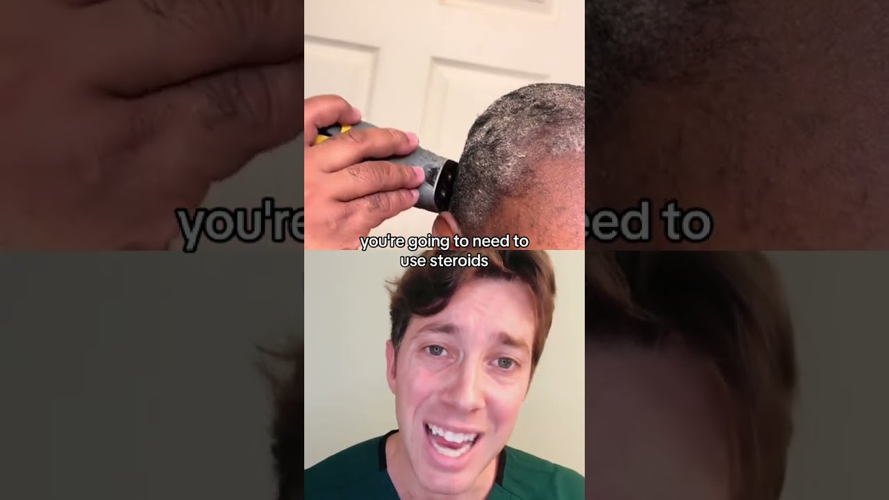 How To Get Rid Of Dandruff Seborrheic Dermatitis