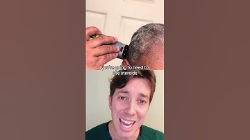 How to Get Rid of Dandruff | Seborrheic Dermatitis