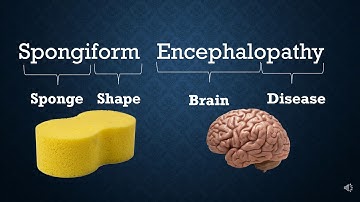 Creutzfeldt–Jakob disease CJD