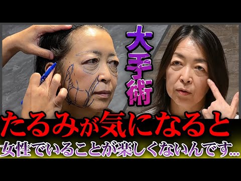 最高峰&究極の若返り手術-本気の方向けハイクラス美容外科-Dr.江連ch