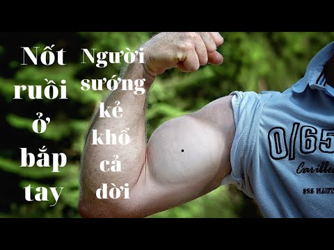 Video Nốt ruồi ở BẮP TAY: Kẻ sướng, người khổ cả đời - youtube