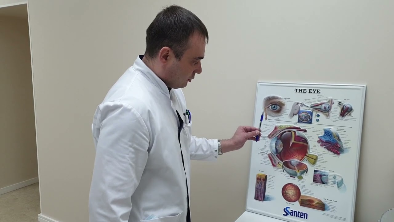 Вторичная катаракта. Быстрый способ лечения фиброза задней капсулы хрусталика