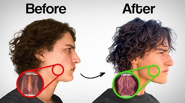 Do This 5-Second Tongue Test... It Might Change Your Whole Face