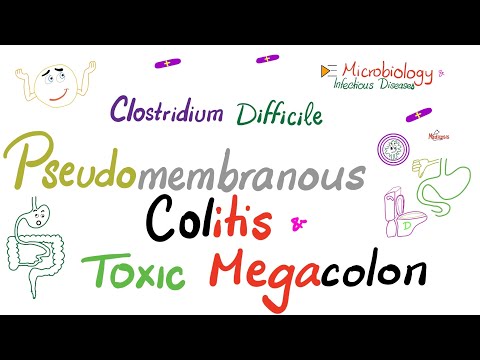 Pseudomembranous Colitis x Toxic Megacolon | Clostrdium Difficile | Microbiology