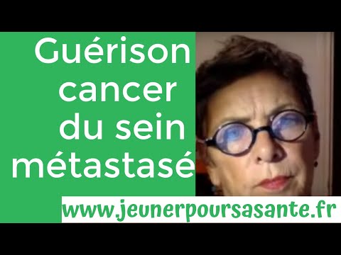Vidéo: Cancer Que Je Pourrais Traiter. Perdre Mon Sein, Je Ne Pouvais Pas