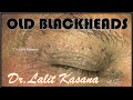 REMOVAL OF 50 YEARS OLD BLACKHEADS (RE UPLOAD)