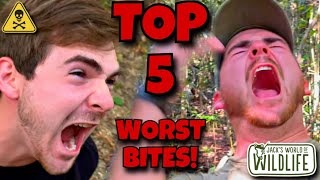 TOP 5 WORST BITES! RANKING My Most Painful Bite Tests!