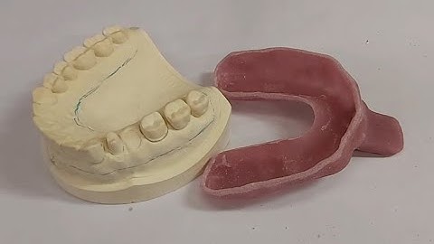 Custom Tray for Fixed Restorations