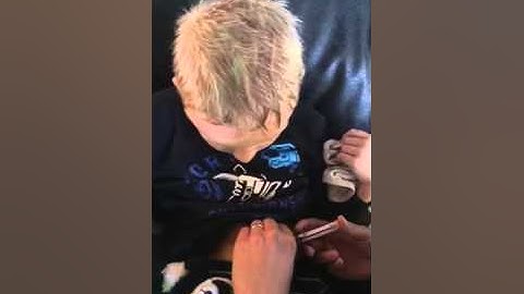 Dexcom G4 CGM insertion on child