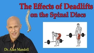 The Effects of Deadlifts on the Spinal Discs (Cons & Pros)  Dr Mandell