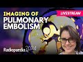 Imaging of pulmonary embolism with sally ayesa