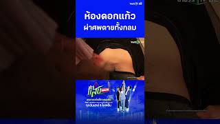 ห้องดอกแก้ว ผ่าศพตายทั้งกลม  | ข่าวแสบเฉพาะกิจ