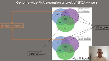 E02.2 - Modeling human lung development and disease using hPSC-derived organoids