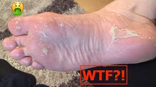 I TRIED A FOOT PEEL! GROSS!! Crusty Feet