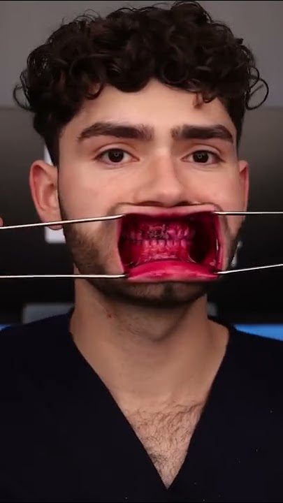 $1 vs $400 Toothbrush Battle!! #shorts