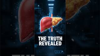 REDUCE FATTY LIVER THE RIGHT WAY — WHAT MOST PEOPLE DON’T KNOW #health #wellness #superfoods