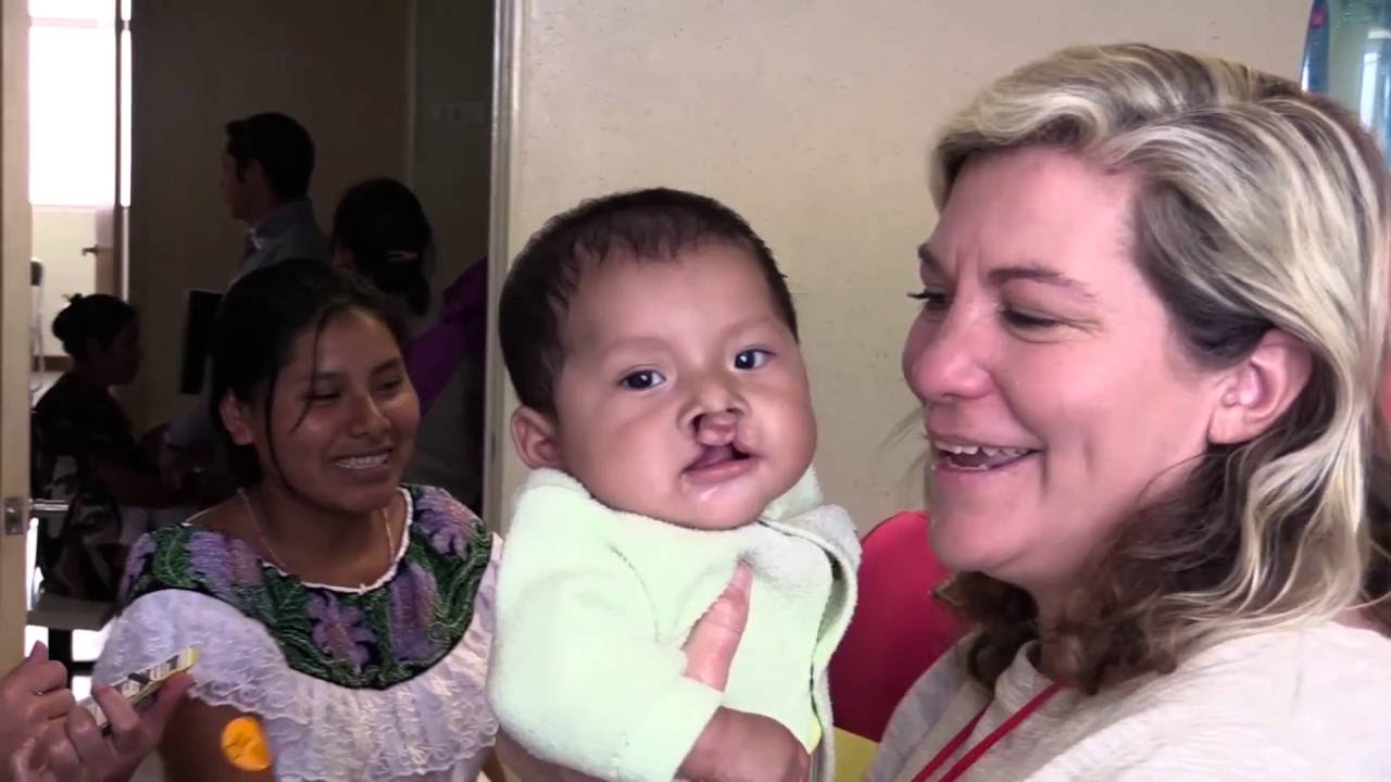 Cydcor And Its Fundraising Partnership with Operation Smile