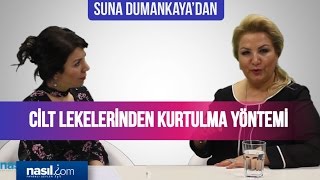 Cilt lekeleri nasıl geçer? Suna Dumankaya'dan tavsiyeler... | Bakım-Güzellik | Nasil.com