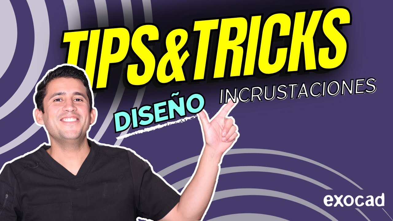 EXOCAD- #1 INCRUSTACIONES TIPS & TRICKS