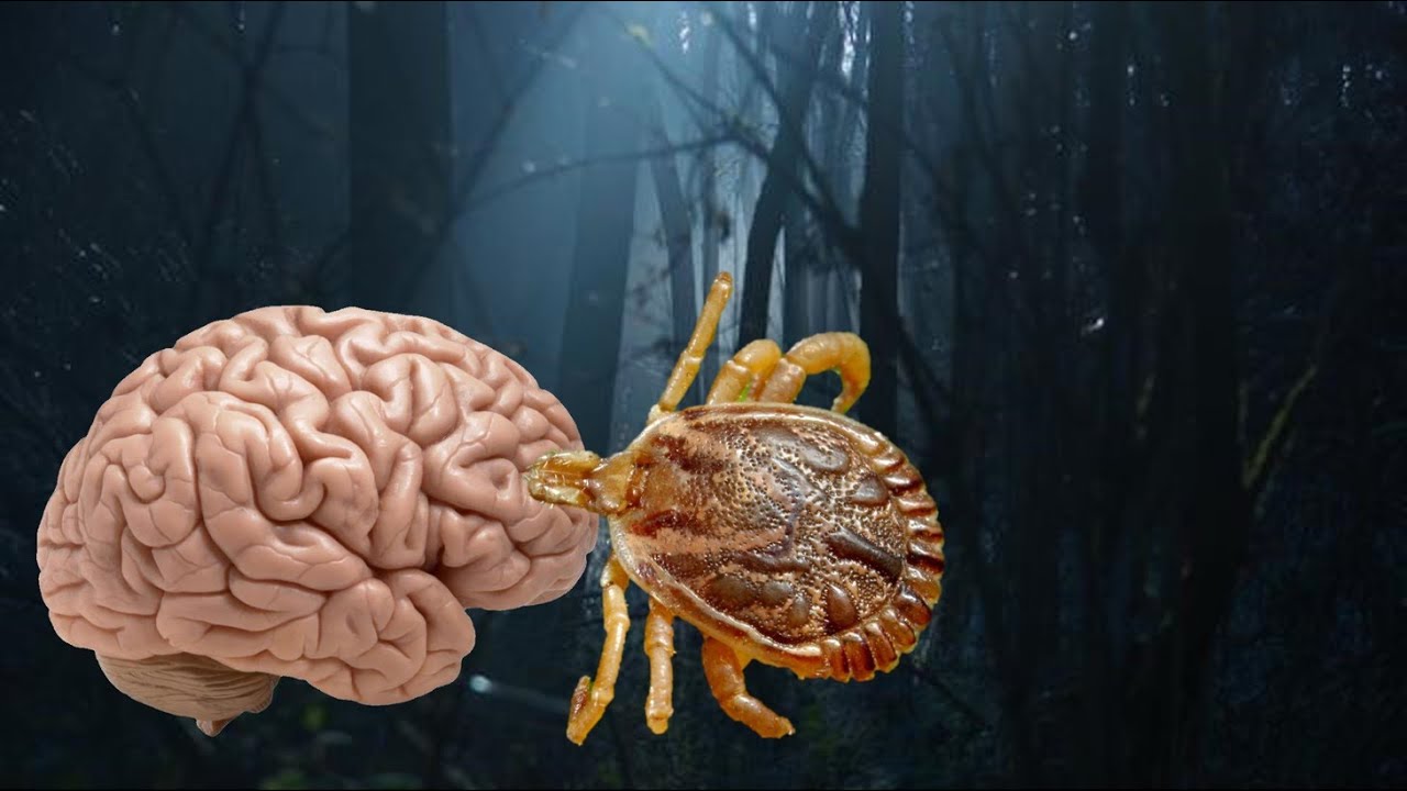 THERE IS A TICK ON YOUR BRAIN - YouTube
