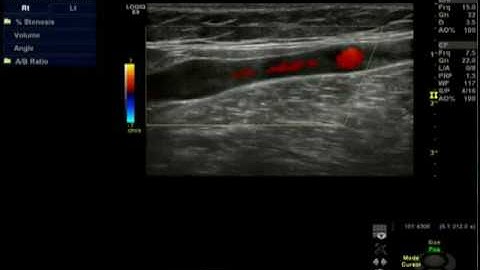 PMS Instruments. Using The Hokanson E20 + AG101.mp4