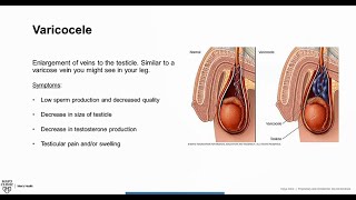 tablete cu varicose pelvis