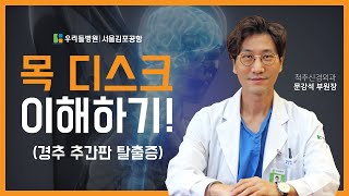 목 디스크 100% 이해하기!! #우리들병원