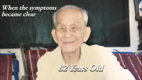 Progression of Alzheimer