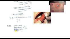 Steven Johnson Syndrome (SJS), Toxic Epidermal Necrolysis (TEN) and Erythema multiforme for USMLE